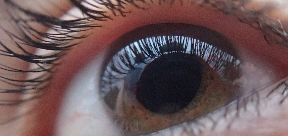 El 95% de ceguera por glaucoma se puede evitar